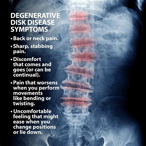 deterioration of the spine